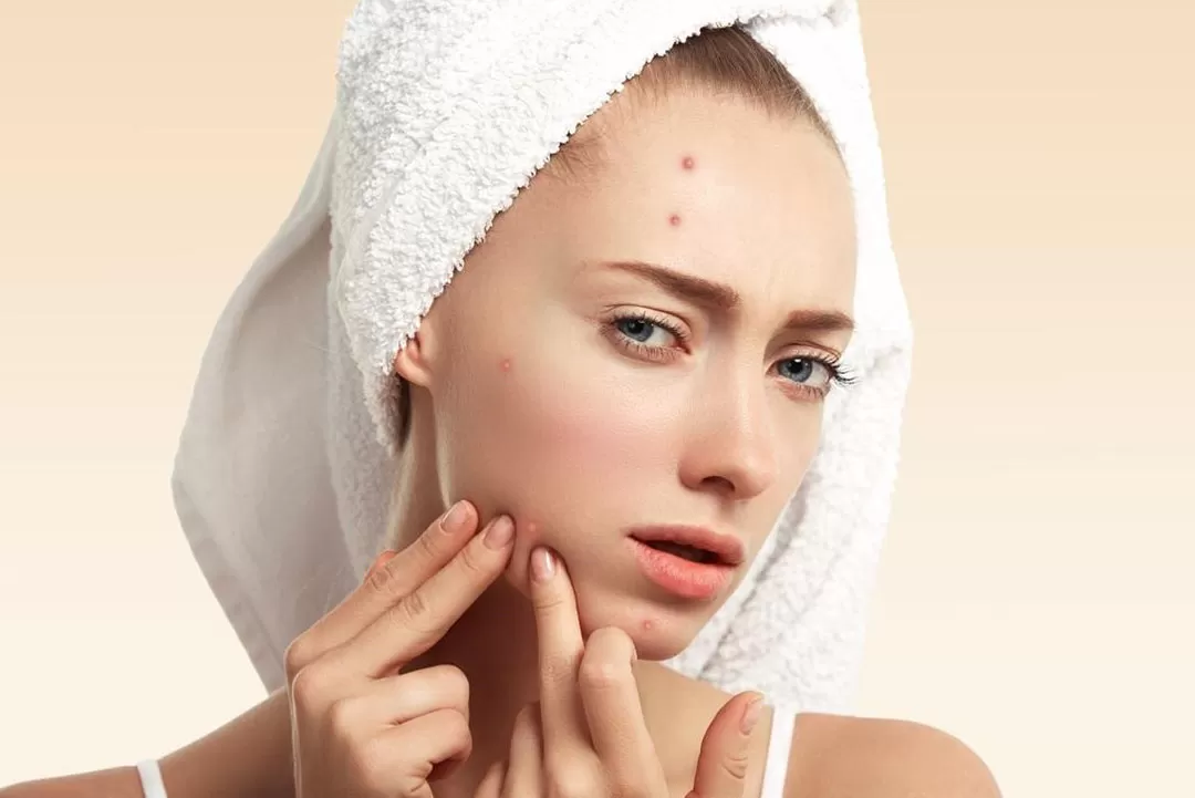XUẤT HIỆN SỮA RỬA MẶT GIÚP GIẢM MỤN MÀ VẪN DỊU NHẸ CHO LÀN DA!
